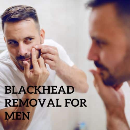 blackhead removal for men