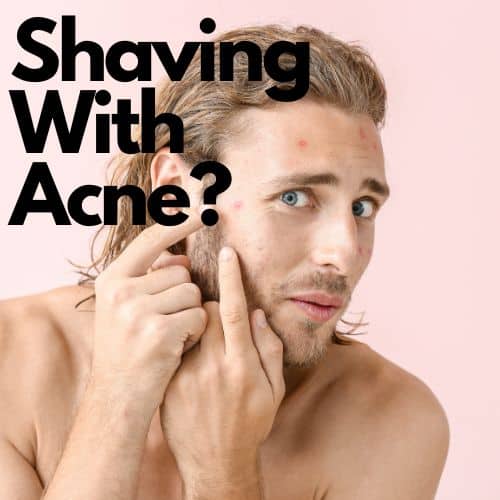 Shaving With Acne