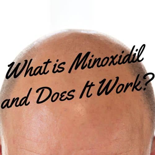 does minoxidil work